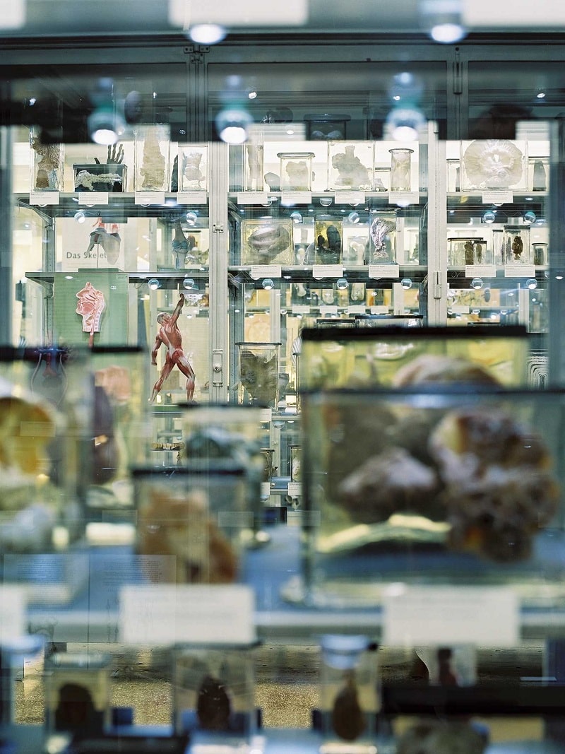 Das Berliner Medizinhistorische Museum der Charité, Präparatevitrinen